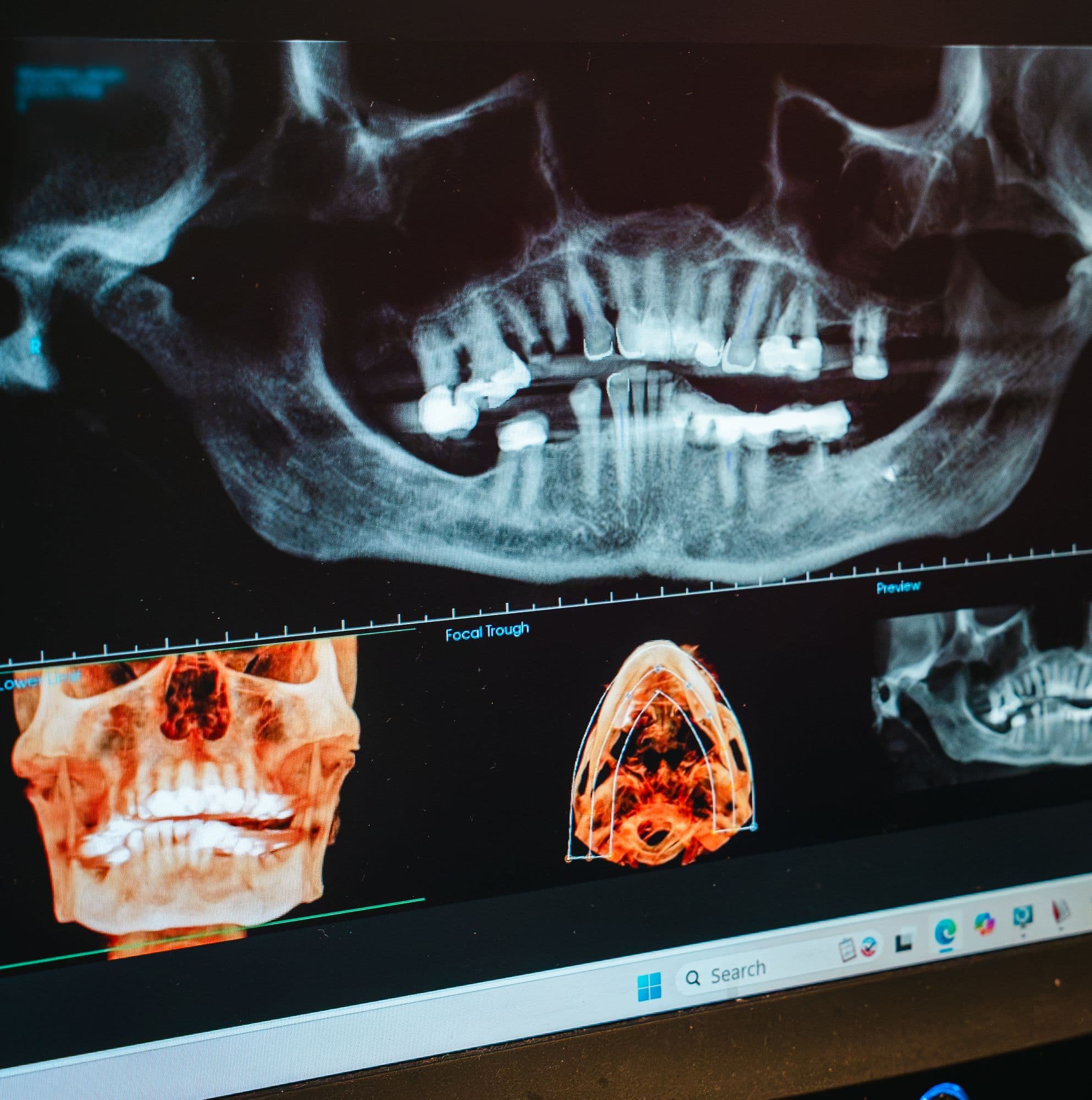3D imaging of the jaw on screen at Park Place Dental