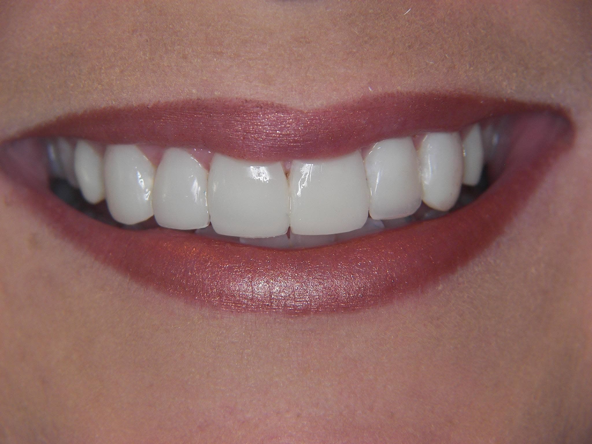 Close view of a finished veneer case