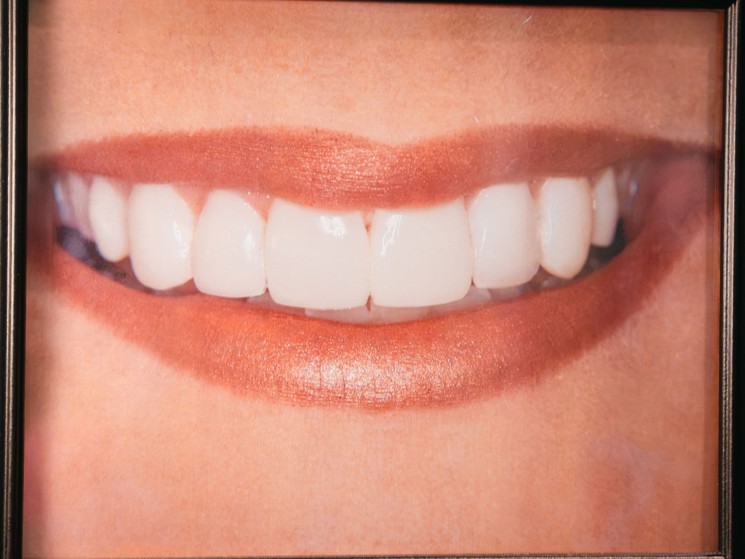 A framed smile photograph on the wall at Park Place Dental